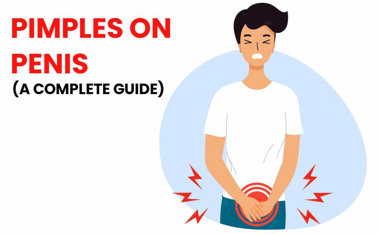 Penis Bumps_ A Comprehensive Guide to Understanding the Causes