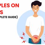 Penis_bumps_a_comprehensive_guide_to_understanding_the_causes