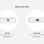Sex During Menstruation Blood Thats Not Normal_1