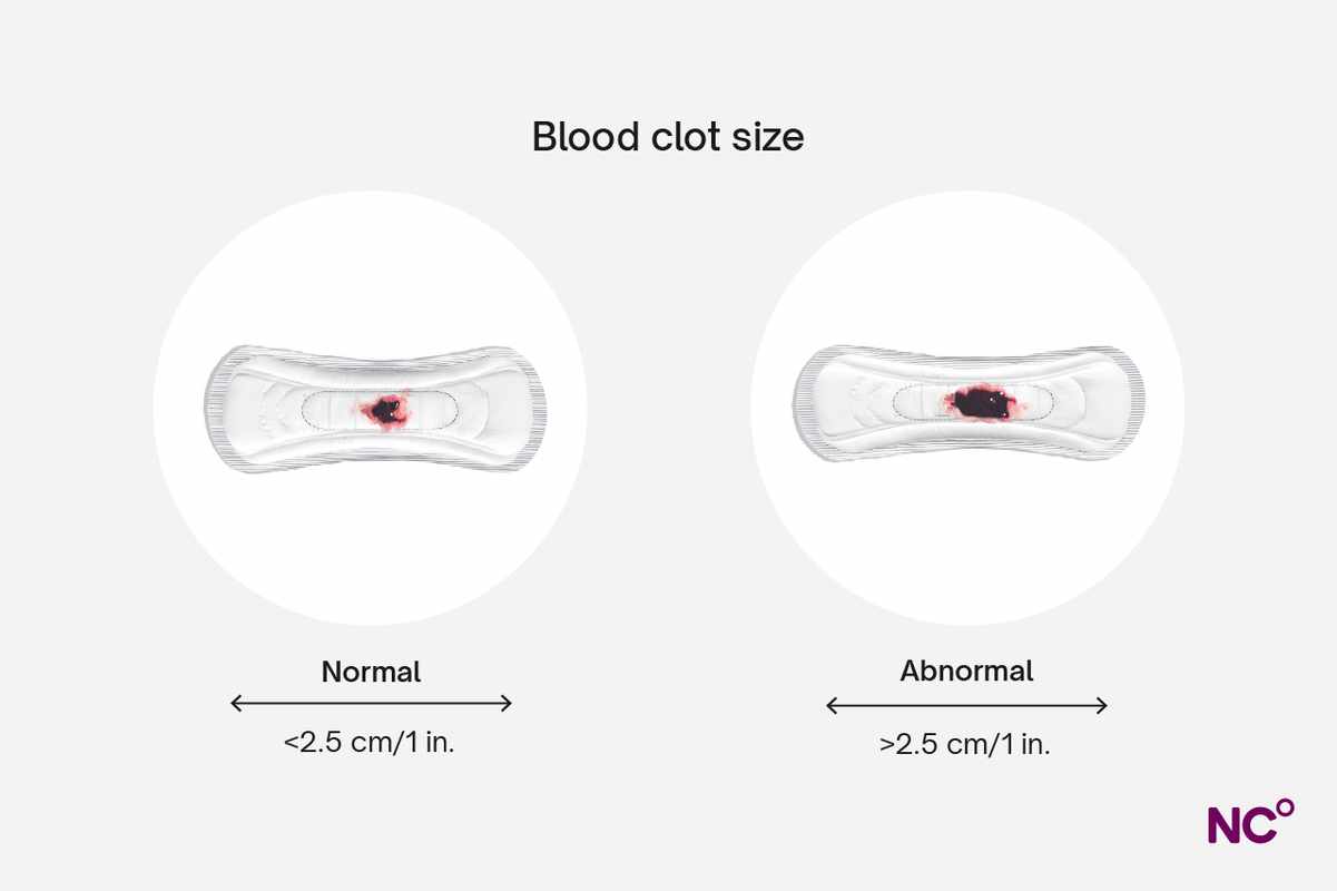 Sex During Menstruation_ Blood That_s Not Normal