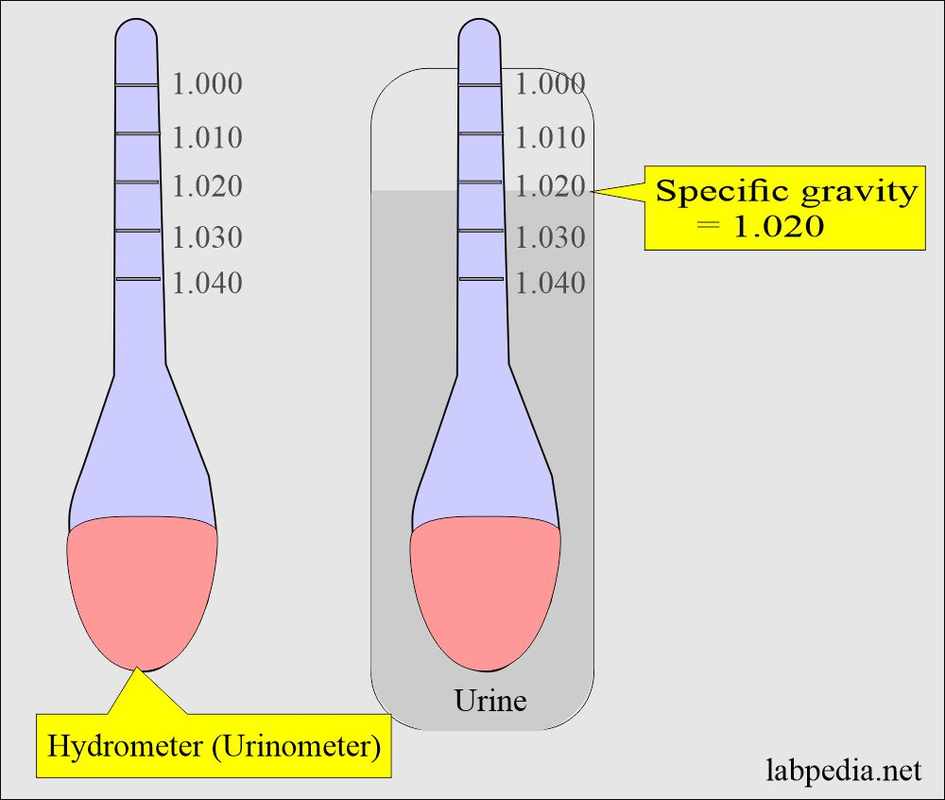 Specific Gravity Urine 1_20