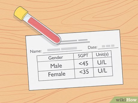 What is a Normal Alt _Sgpt_ Range_