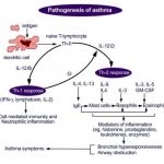 asthma is an example of atopy what are other types of atopy quizlet_1