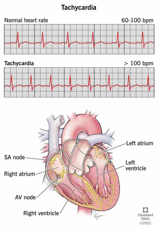 at Rest_ The Normal Adult Heart Rate Should Not Exceed