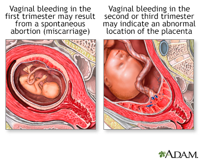 bright red blood after sex during pregnancy